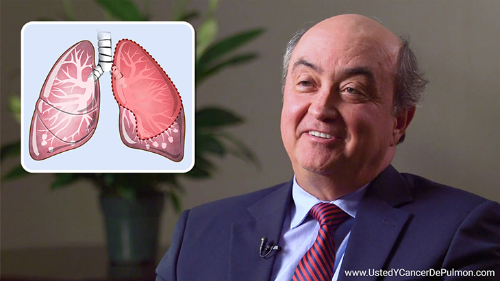 ¿Qué factores determinan el alcance de la cirugía de cáncer de pulmón?